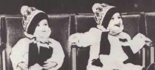 1990年5月18日：苏联首例颅骨连体儿分离成功