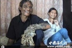 奇人奇事 迪德：魔戒中的树人竟然真实存在