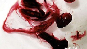 明末三案之明朝东宫“梃击案”之谜，案件过程介绍！