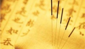 中国针灸简介：中国针灸有哪些特点 如何评价中国针灸？