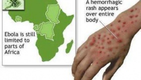 埃博拉病毒是什么病 埃博拉病毒是如何传播的？