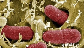 沙门氏菌介绍 本福德定律解析 阿列纽斯方程式