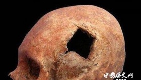 古代人有开颅手术吗 古代人治疗脑科疾病的方法
