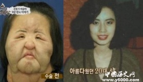韩国风扇女去世韩国风扇女简历风扇女为什么会痴迷整容