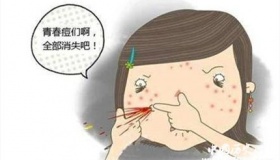 大学生青春痘困扰 大学生青春痘怎么治疗