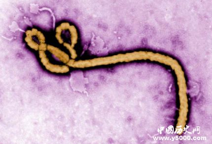 日本将引入埃博拉_日本引入埃博拉的原因是什么