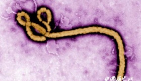 日本将引入埃博拉等致命病毒