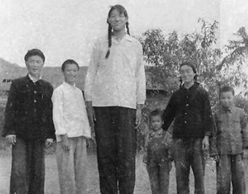 世界上最高的女人：曾金莲身高2.48米