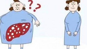 脂肪肝是怎么回事