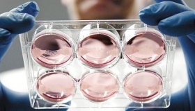 人造肉是什么做的