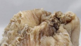 太岁究竟是什么东西